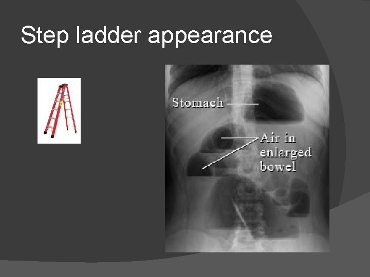 Step ladder appearance 