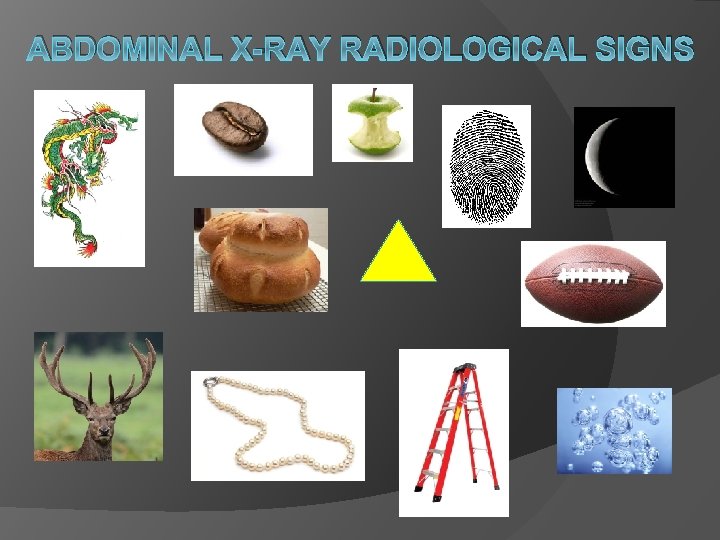ABDOMINAL X-RAY RADIOLOGICAL SIGNS 