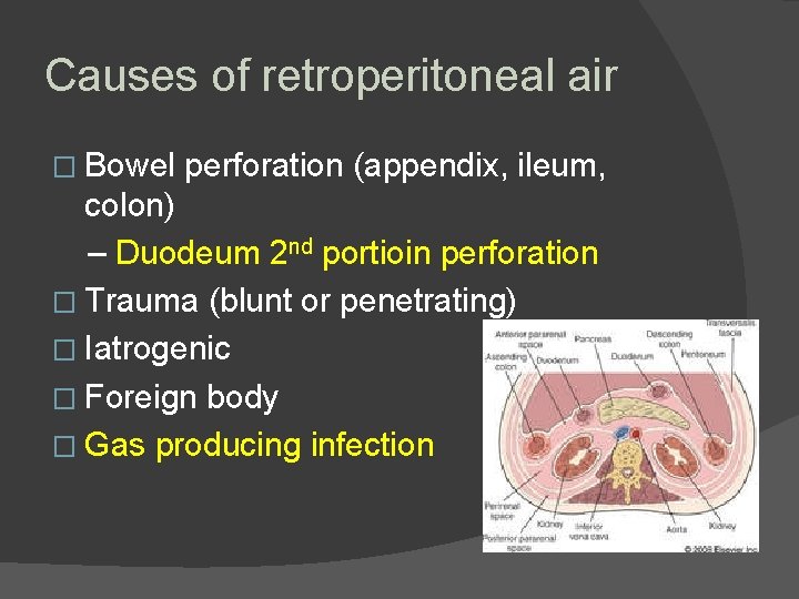 Causes of retroperitoneal air � Bowel perforation (appendix, ileum, colon) – Duodeum 2 nd