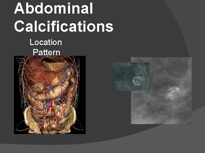 Abdominal Calcifications Location Pattern 
