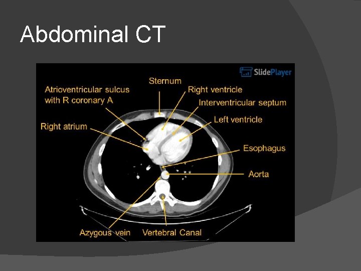 Abdominal CT 