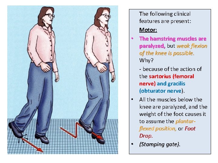 The following clinical features are present: Motor: • The hamstring muscles are paralyzed, but