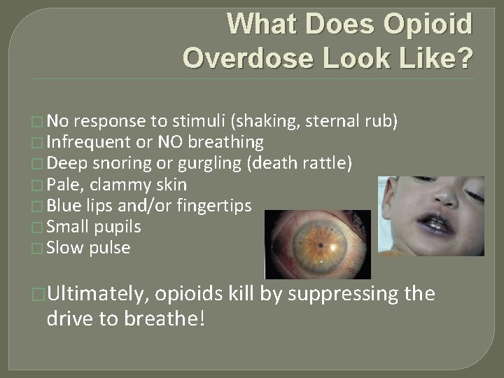 What Does Opioid Overdose Look Like? � No response to stimuli (shaking, sternal rub)