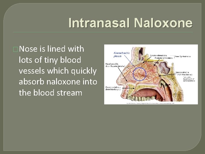 Intranasal Naloxone �Nose is lined with lots of tiny blood vessels which quickly absorb