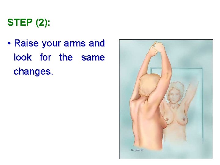 STEP (2): • Raise your arms and look for the same changes. 