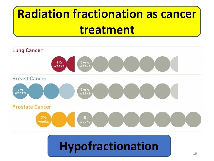 Radiation fractionation as cancer treatment Hypofractionation 19 