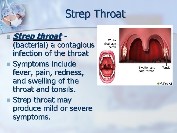Strep Throat n Strep throat - (bacterial) a contagious infection of the throat n