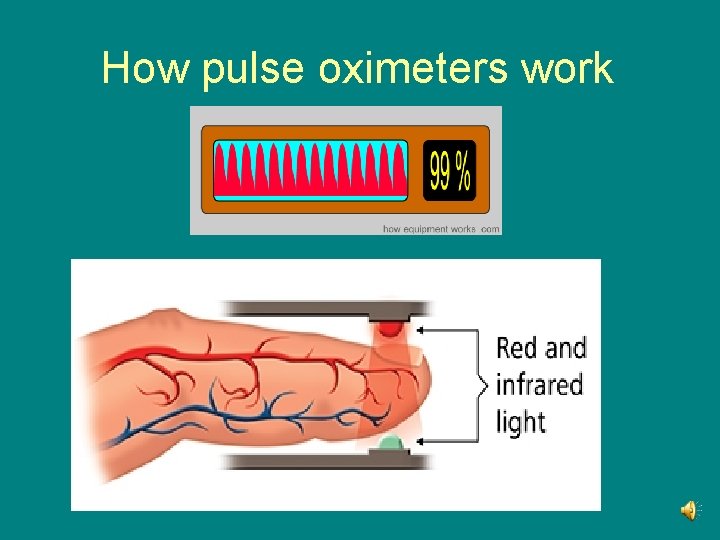 How pulse oximeters work 