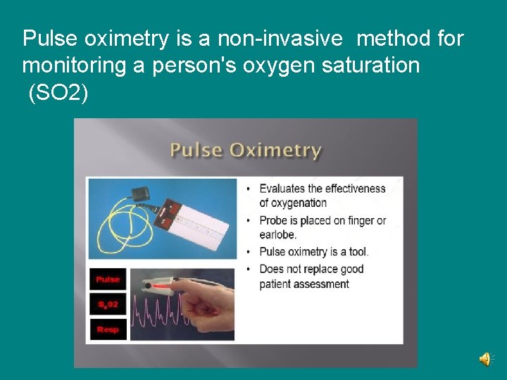 Pulse oximetry is a non-invasive method for monitoring a person's oxygen saturation (SO 2)