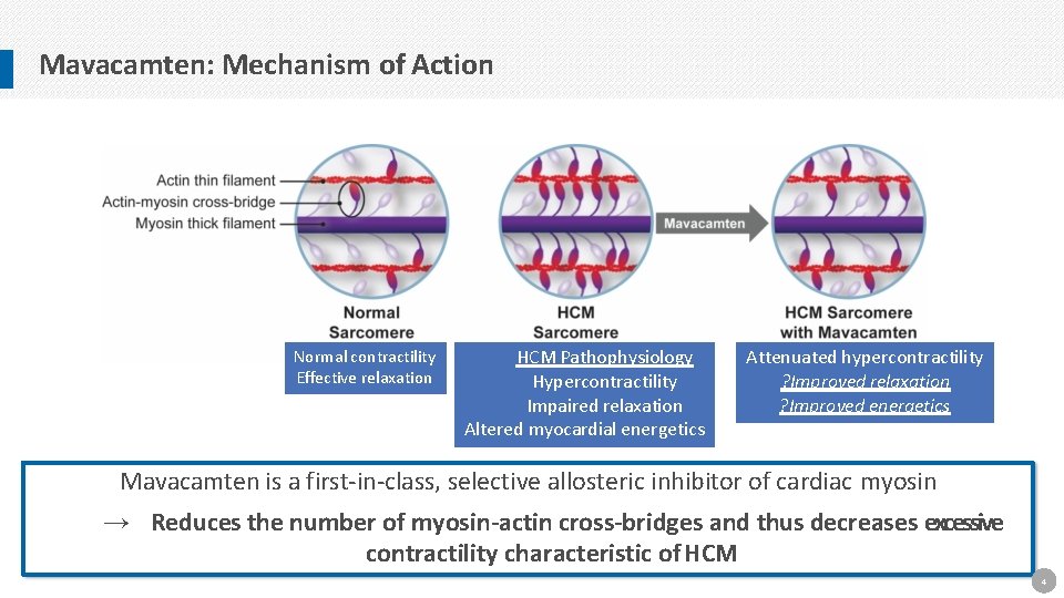 Mavacamten: Mechanism of Action Normal contractility Effective relaxation HCM Pathophysiology Hypercontractility Impaired relaxation Altered