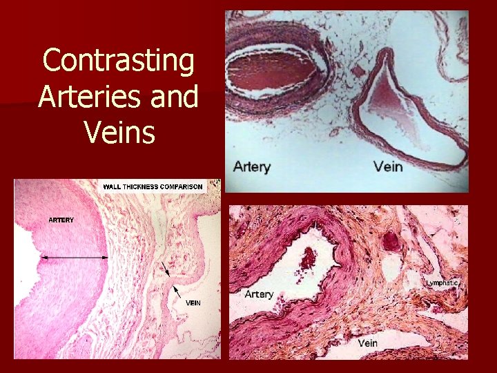 Contrasting Arteries and Veins 