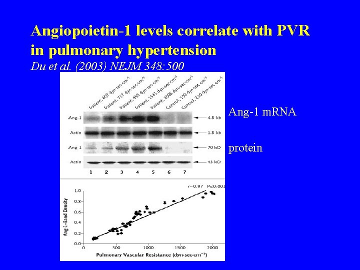 Angiopoietin-1 levels correlate with PVR in pulmonary hypertension Du et al. (2003) NEJM 348:
