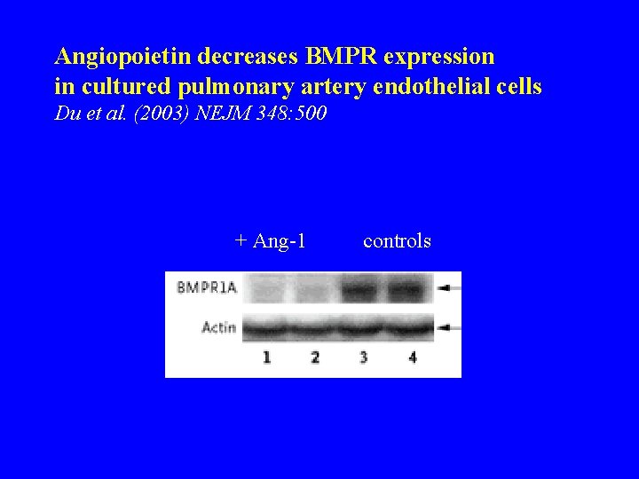 Angiopoietin decreases BMPR expression in cultured pulmonary artery endothelial cells Du et al. (2003)