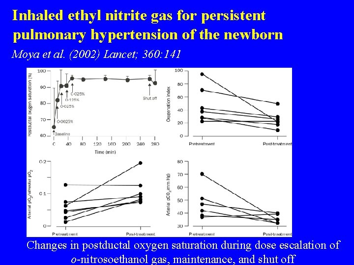 Inhaled ethyl nitrite gas for persistent pulmonary hypertension of the newborn Moya et al.