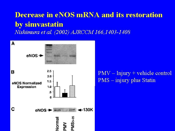 Decrease in e. NOS m. RNA and its restoration by simvastatin Nishimura et al.