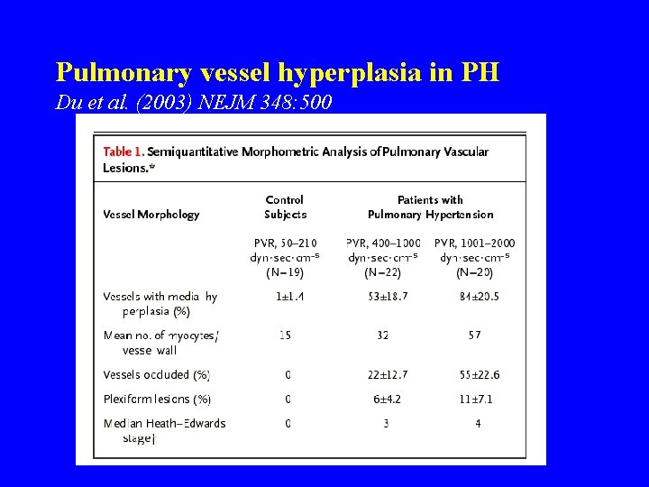 Pulmonary vessel hyperplasia in PH Du et al. (2003) NEJM 348: 500 