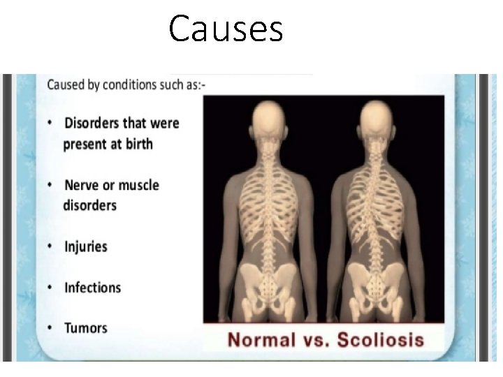 Causes 