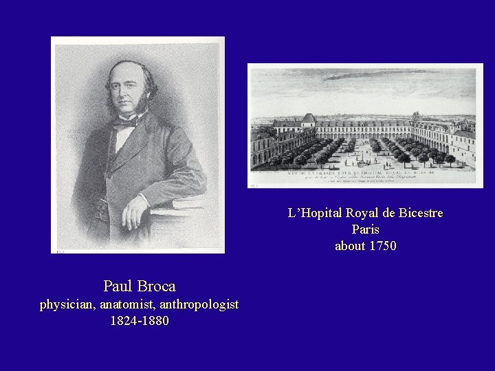 L’Hopital Royal de Bicestre Paris about 1750 Paul Broca physician, anatomist, anthropologist 1824 -1880