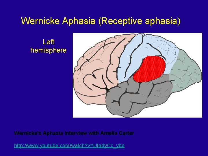 Wernicke Aphasia (Receptive aphasia) Left hemisphere Wernicke's Aphasia Interview with Amelia Carter http: //www.