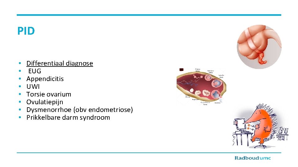 PID • • Differentiaal diagnose EUG Appendicitis UWI Torsie ovarium Ovulatiepijn Dysmenorrhoe (obv endometriose)