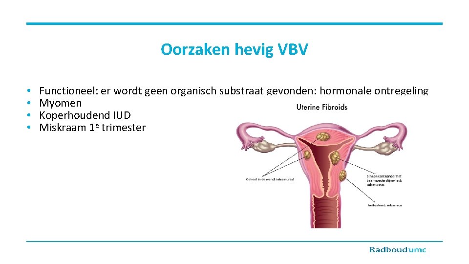 Oorzaken hevig VBV • • Functioneel: er wordt geen organisch substraat gevonden: hormonale ontregeling