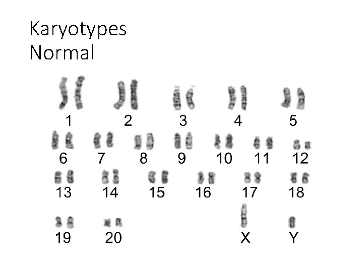 Karyotypes Normal 