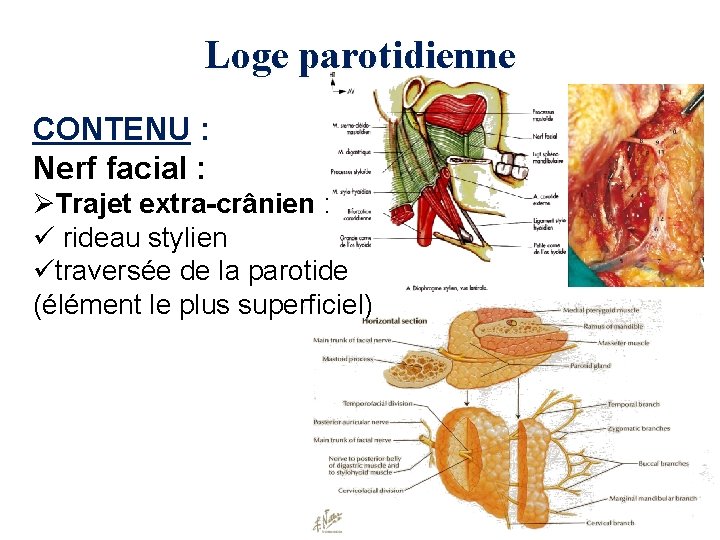 Loge parotidienne CONTENU : Nerf facial : ØTrajet extra-crânien : ü rideau stylien ütraversée