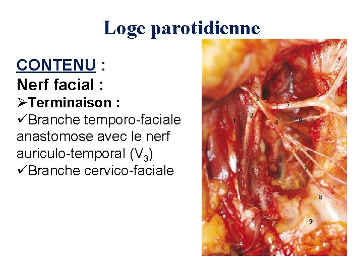 Loge parotidienne CONTENU : Nerf facial : ØTerminaison : üBranche temporo-faciale anastomose avec le