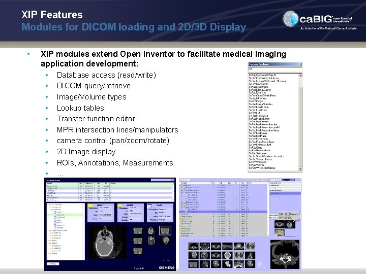 XIP Features Modules for DICOM loading and 2 D/3 D Display • XIP modules