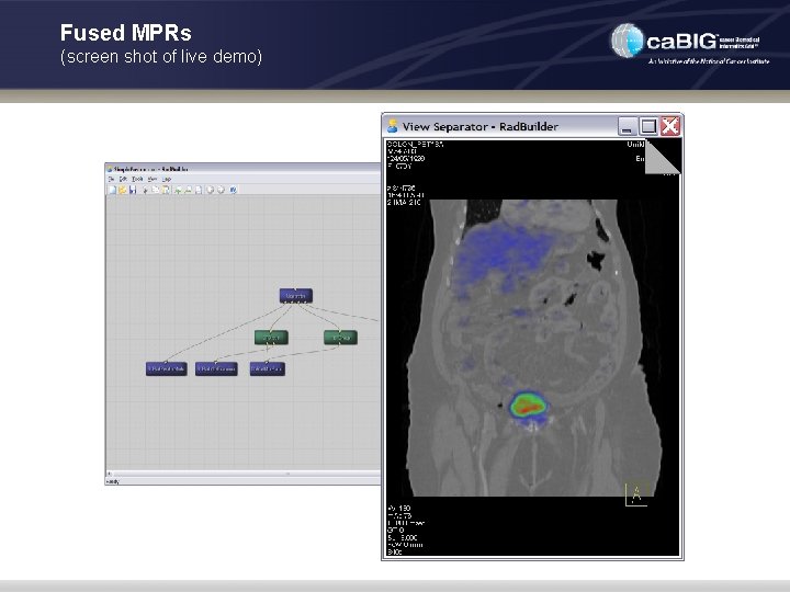 Fused MPRs (screen shot of live demo) 