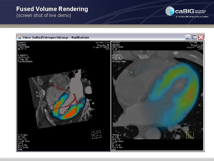 Fused Volume Rendering (screen shot of live demo) 