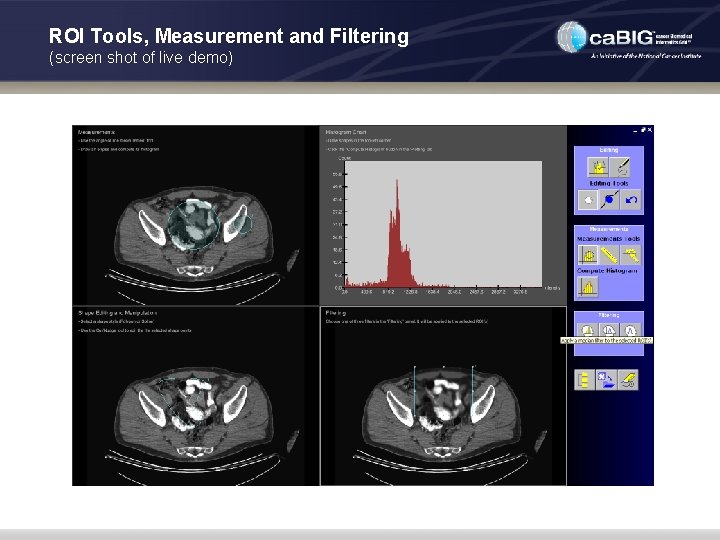 ROI Tools, Measurement and Filtering (screen shot of live demo) 