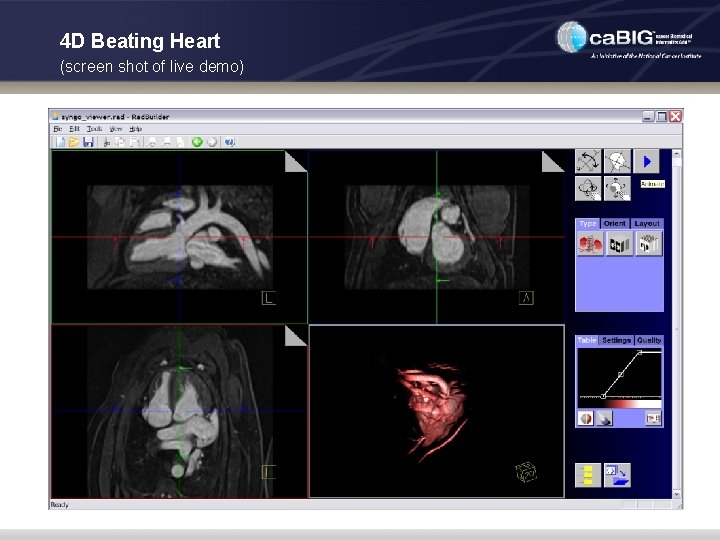 4 D Beating Heart (screen shot of live demo) 