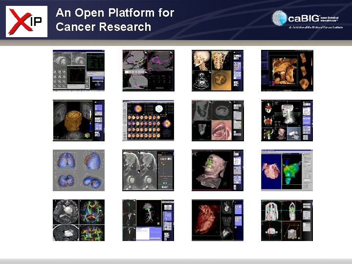 An Open Platform for Cancer Research 