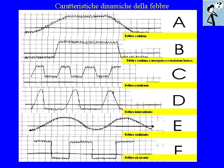 Caratteristiche dinamiche della febbre Febbre continua a insorgenza e remissione brusca Febbre remittente Febbre