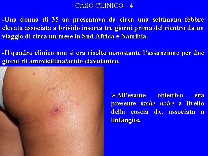 CASO CLINICO - 4 -Una donna di 35 aa presentava da circa una settimana