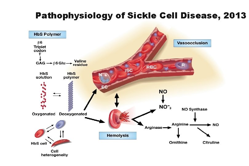 Sickle Cell Disease Martin H Steinberg Department of