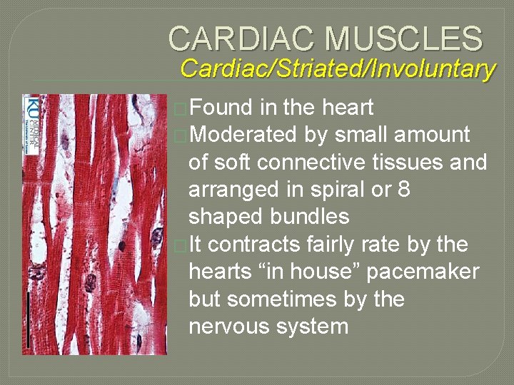CARDIAC MUSCLES Cardiac/Striated/Involuntary �Found in the heart �Moderated by small amount of soft connective