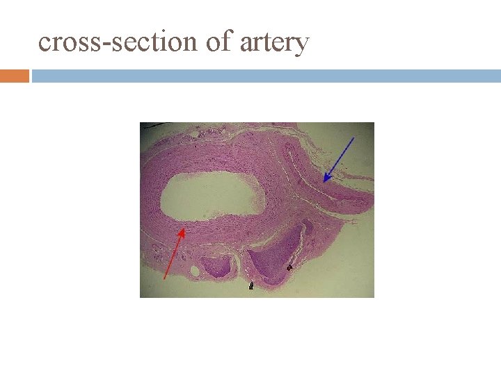 cross-section of artery 