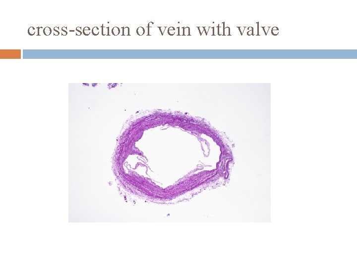 cross-section of vein with valve 