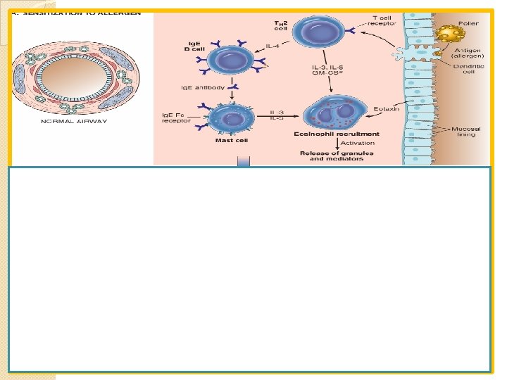 Pathogenesis of Bronchial Asthma using Atopic Asthma as a model Late phase reaction/ late