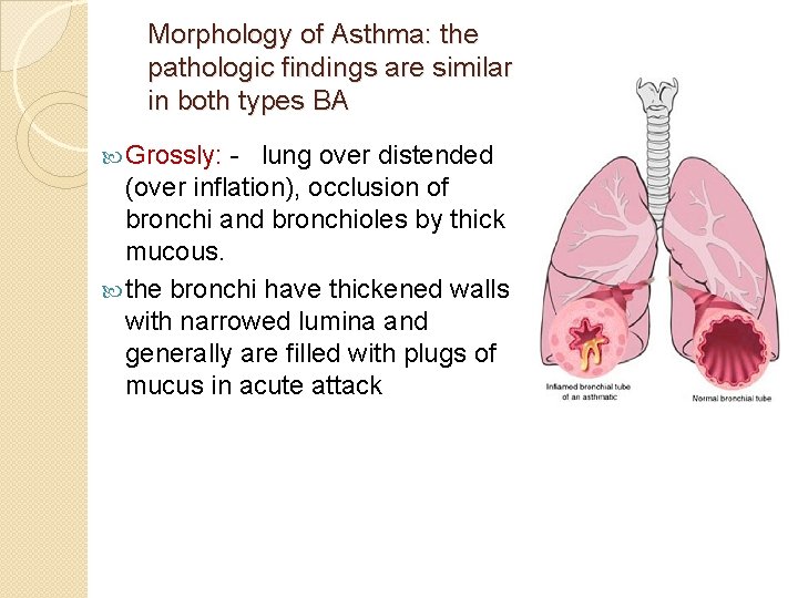 Morphology of Asthma: the pathologic findings are similar in both types BA Grossly: -