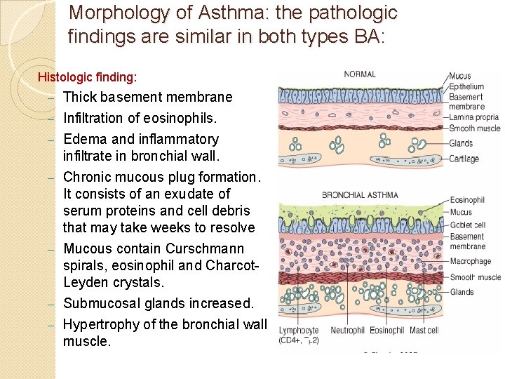 Morphology of Asthma: the pathologic findings are similar in both types BA: Histologic finding: