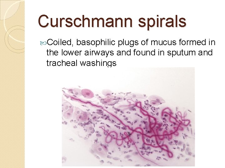 Curschmann spirals Coiled, basophilic plugs of mucus formed in the lower airways and found