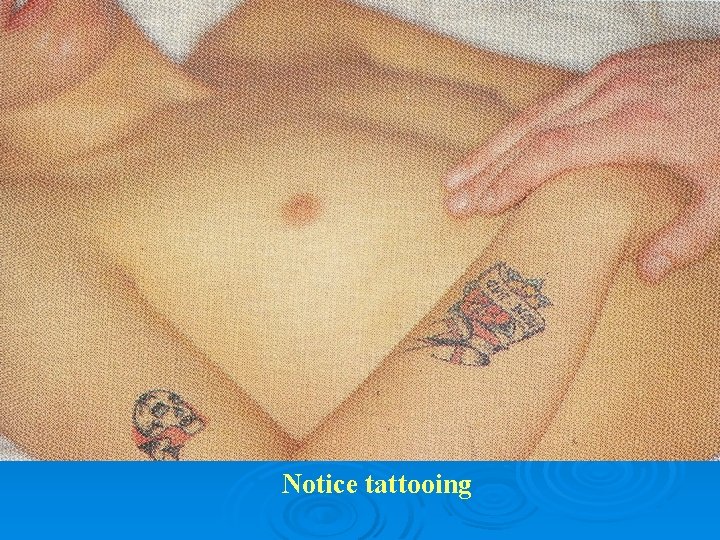 Notice tattooing 