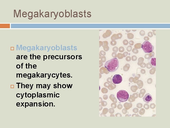 Megakaryoblasts are the precursors of the megakarycytes. They may show cytoplasmic expansion. 