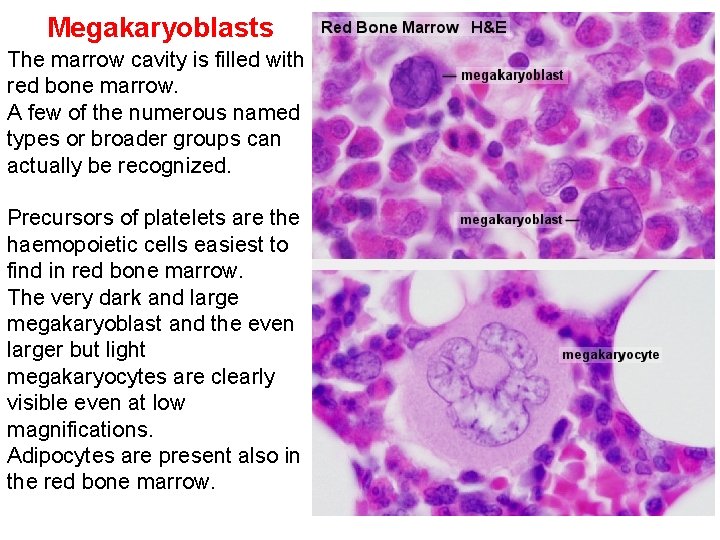 Megakaryoblasts The marrow cavity is filled with red bone marrow. A few of the