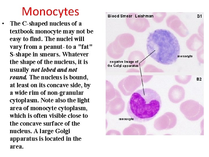 Monocytes • The C-shaped nucleus of a textbook monocyte may not be easy to
