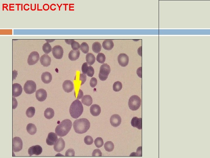 RETICULOCYTE 