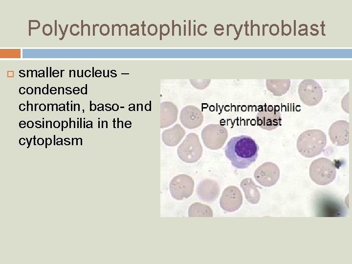 Polychromatophilic erythroblast smaller nucleus – condensed chromatin, baso- and eosinophilia in the cytoplasm 